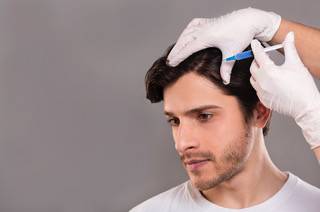 Les traitements pour augmenter la densité des cheveux (méso-greffe, facteurs de croissance, mésothérapie)